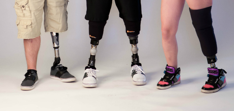 lower-limb-prosthetics-for-amputees